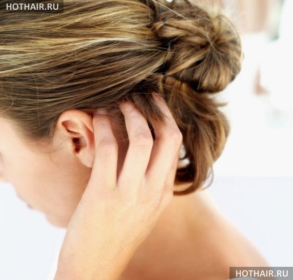 как избавиться от зуда головы?