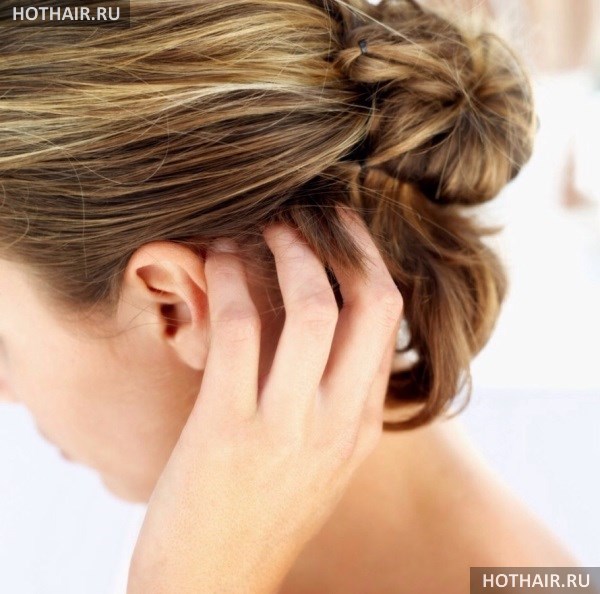 от чего чешется голова?