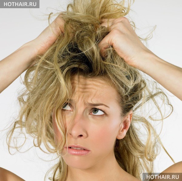 лечение себореи головы