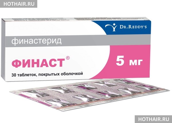Лечение при андрогенной алопеции у женщин